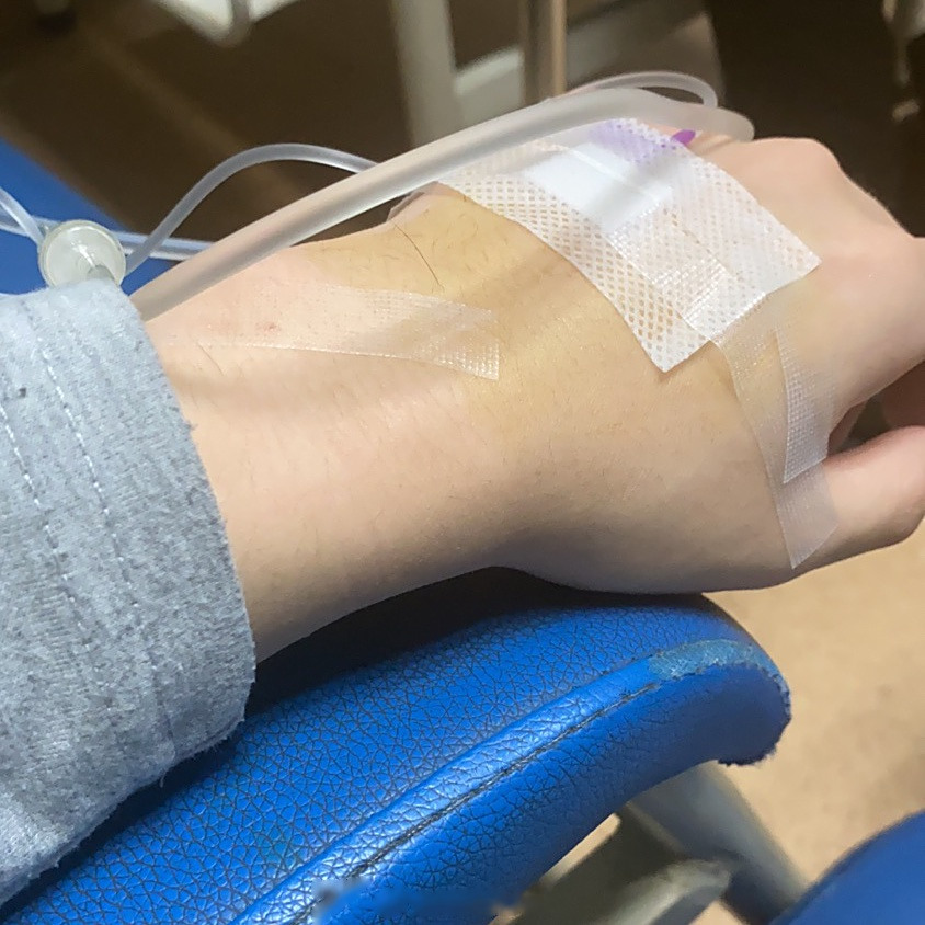 又是扁桃体的问题[流泪] 高烧39度[生病] 白天核酸晚上挂盐水[骷髅]