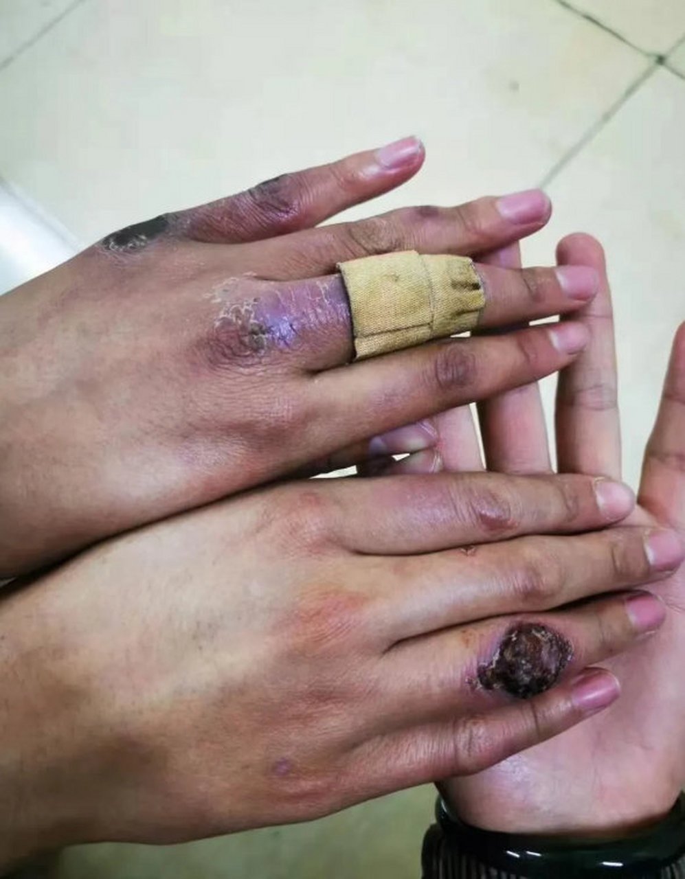 这是一双西藏边防女兵的手,心疼,致敬女兵,致敬中国军人!