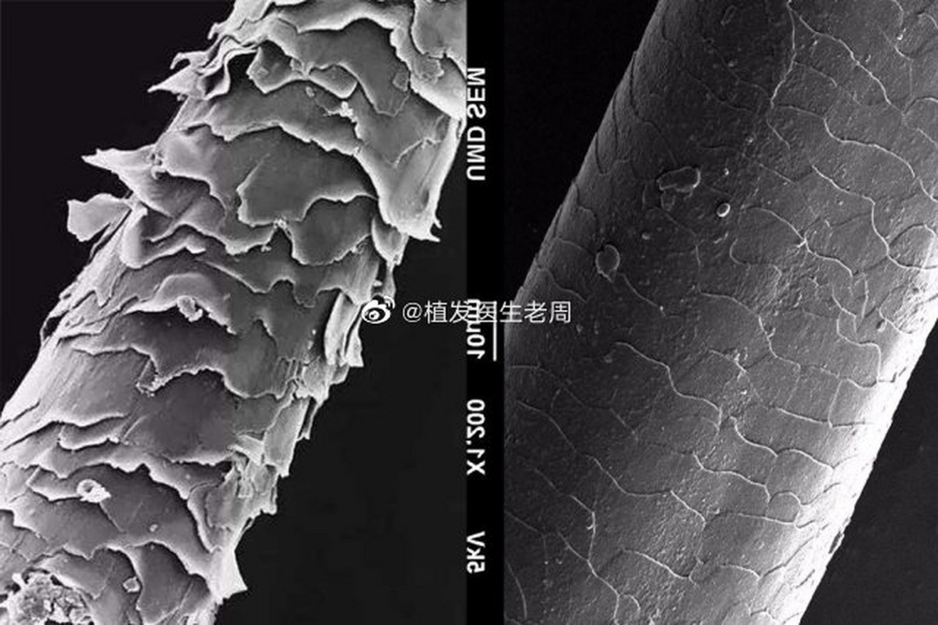 610202毛鳞片有助于提升头发强度,抵御外来伤害,保护皮质