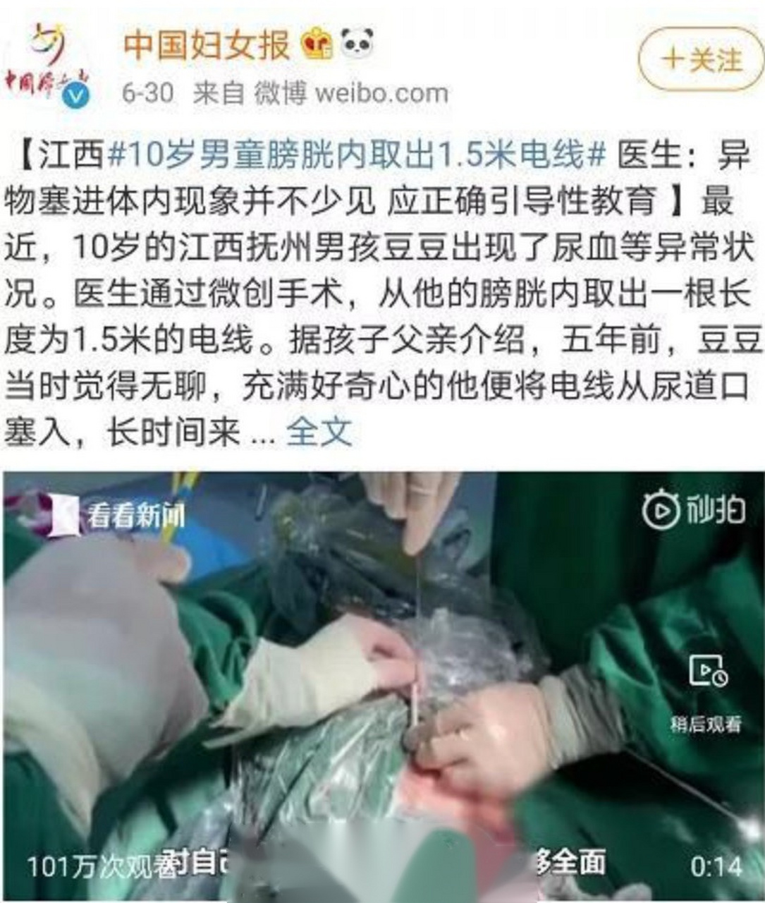5米电线】上个月,江西一名10岁男童通过手术,从膀胱中取出了1.