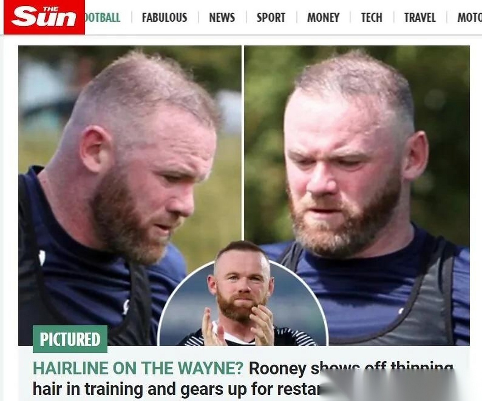 鲁尼的植发效果惨不忍睹啊 (责任编辑:大能喵)