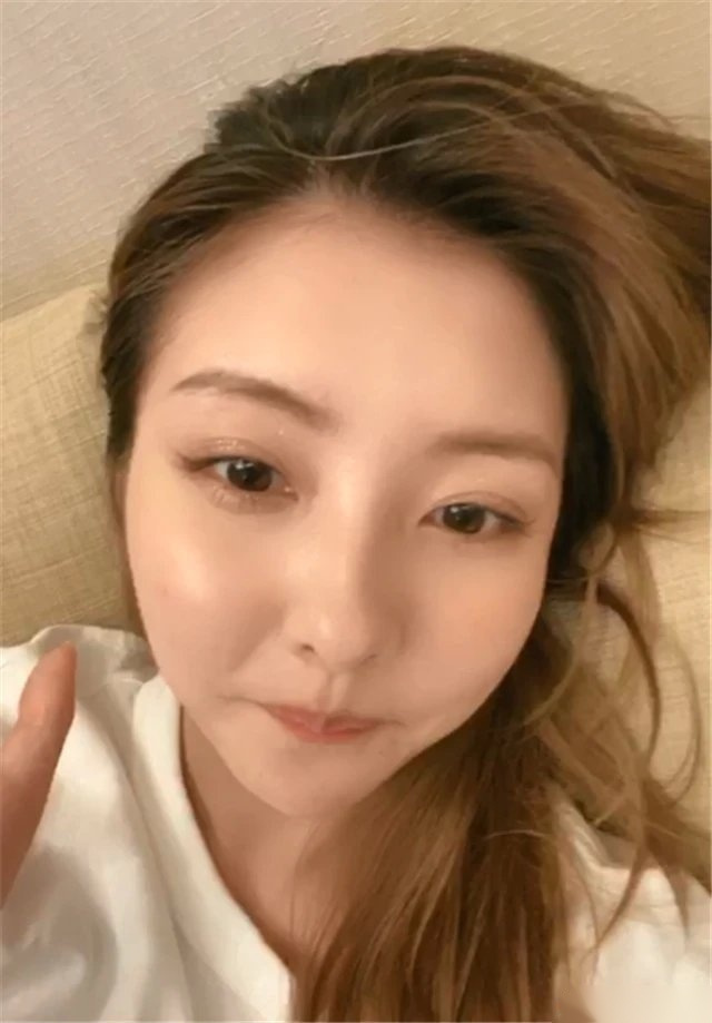 王思聪前女友豆得儿素颜直播,大谈整容经验,自曝经常打玻尿酸.