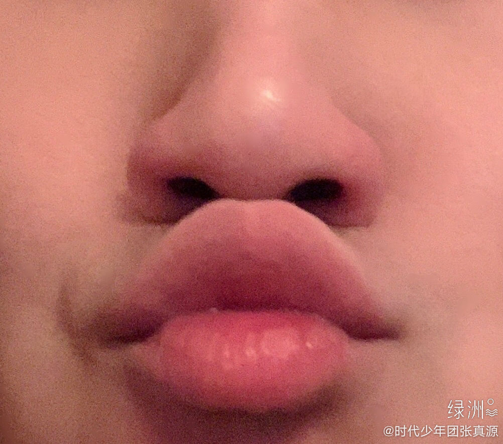发现一个新的特技,我的嘴唇撅起来可以碰到鼻尖,大家可以尝试一下