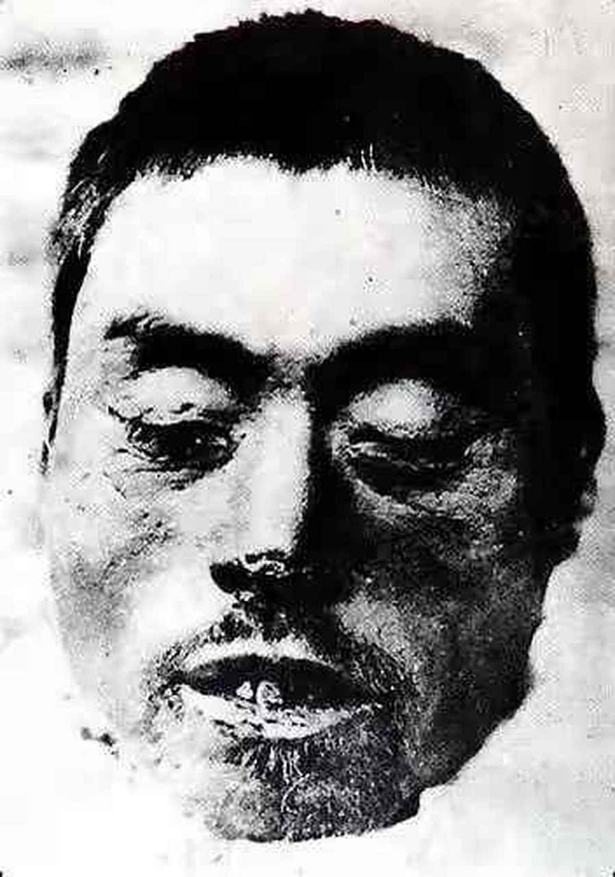 为解疑惑,他们命令蒙江县城民众医院的医生解剖检查