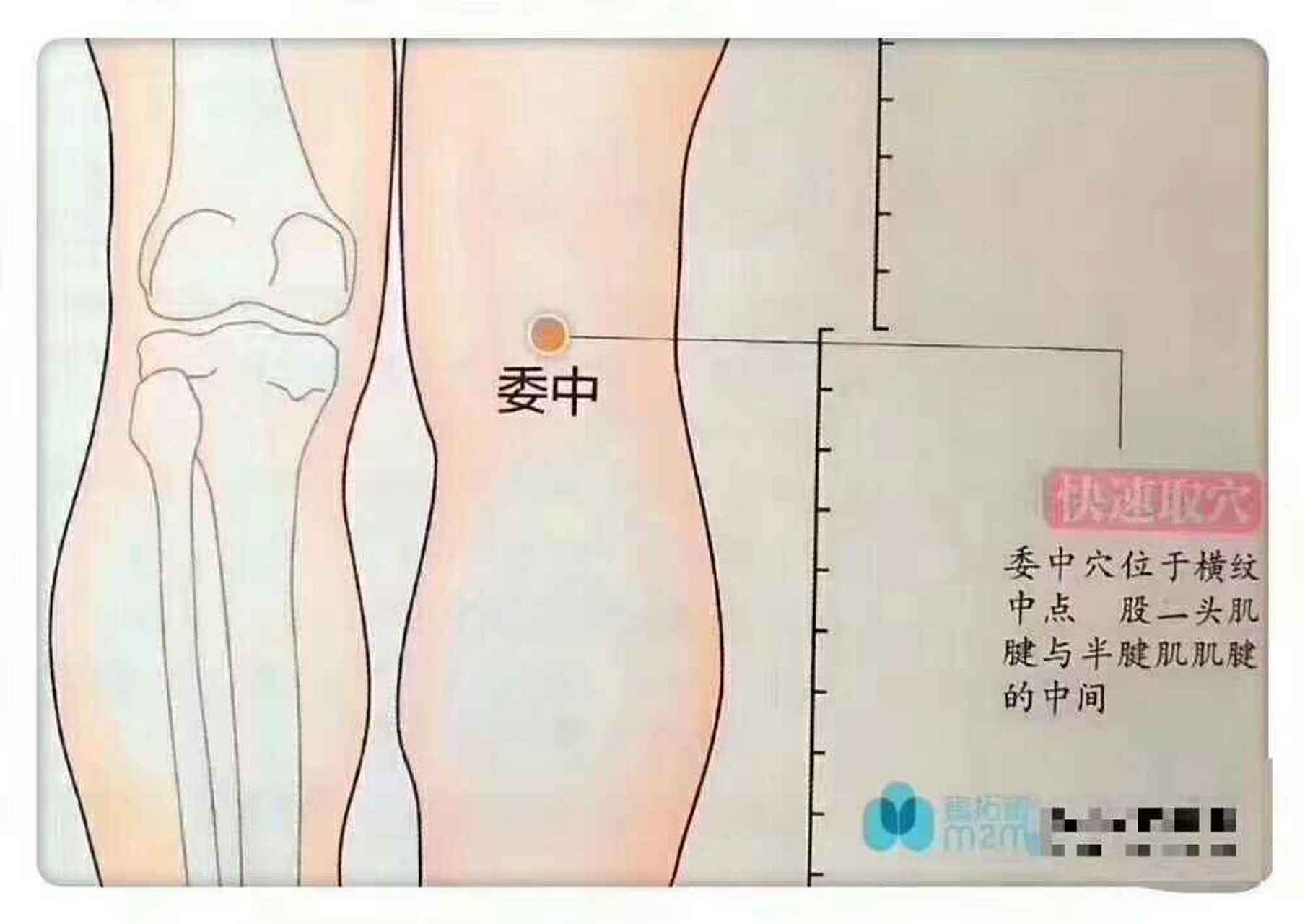 【委中穴 主治 腰腿无力,腰痛,坐骨神经痛 委中穴是中医经络